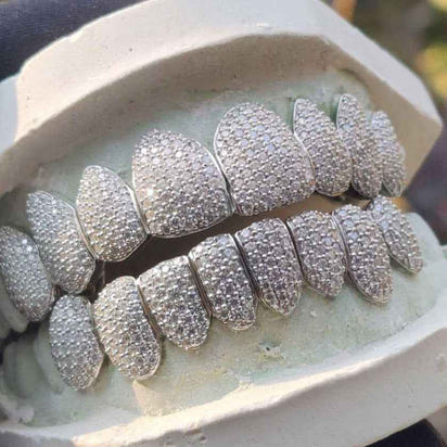 Moissanite Grillz (Custom Mold)