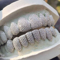 Moissanite Grillz (Custom Mold)