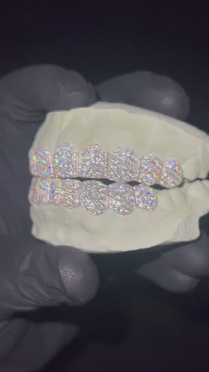 Moissanite Grillz (Custom Mold)